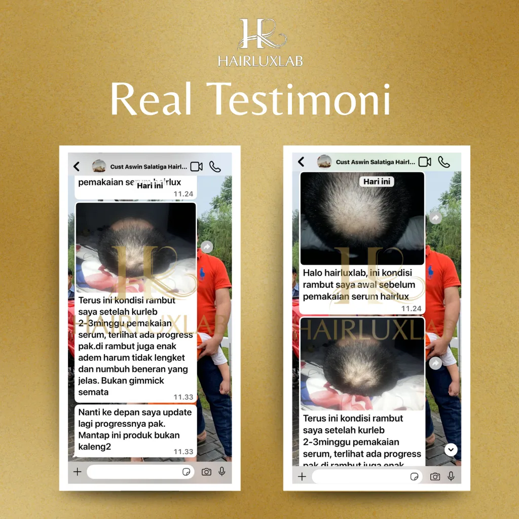 Dokumentasi testimoni pembeli HairLuxLab berisi tangkapan layar percakapan dan foto kondisi rambut