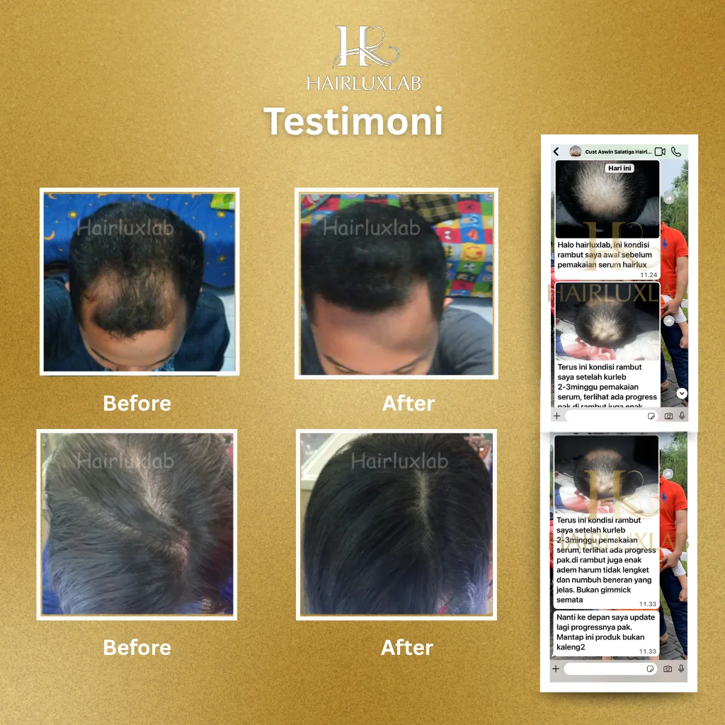 Dokumentasi testimoni pembeli HairLuxLab berisi tangkapan layar ulasan dan foto kondisi rambut