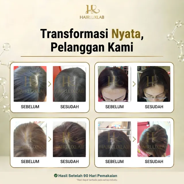 Kolase foto kulit kepala pembeli wanita sebelum dan sesudah pemakaian HairLuxLab