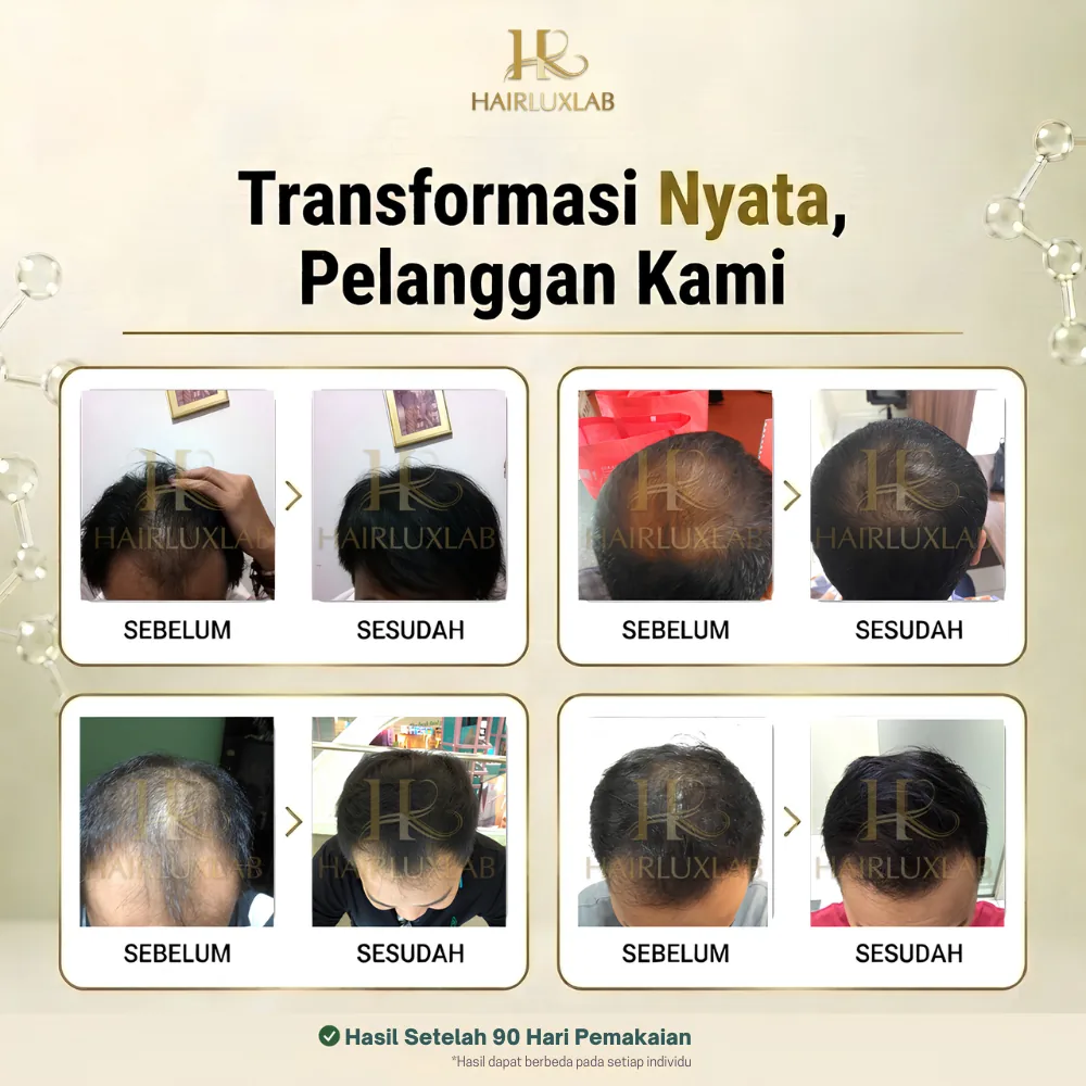 Dokumentasi testimoni pembeli pria HairLuxLab berisi tangkapan layar percakapan