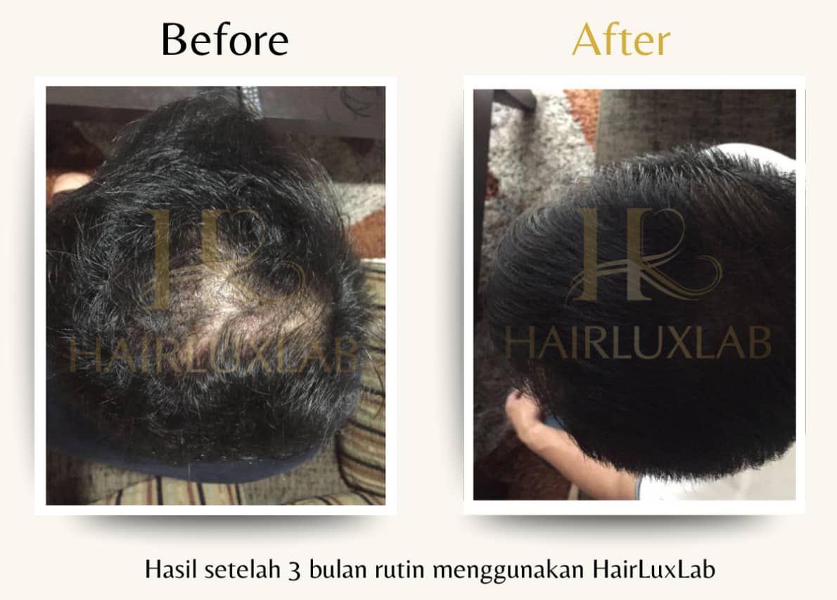 Testimoni Hairluxlab